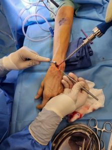 wrist-and-hand-1-66