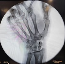 wrist-and-hand-1-69