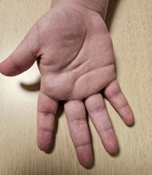 wrist-and-hand-1-72