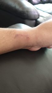 wrist-and-hand-37