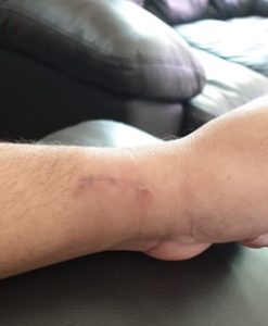 wrist-and-hand-37